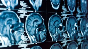 Read more about the article Learning lessons from medical imaging about what AI transformation really means